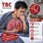 Ilustrasi TBC